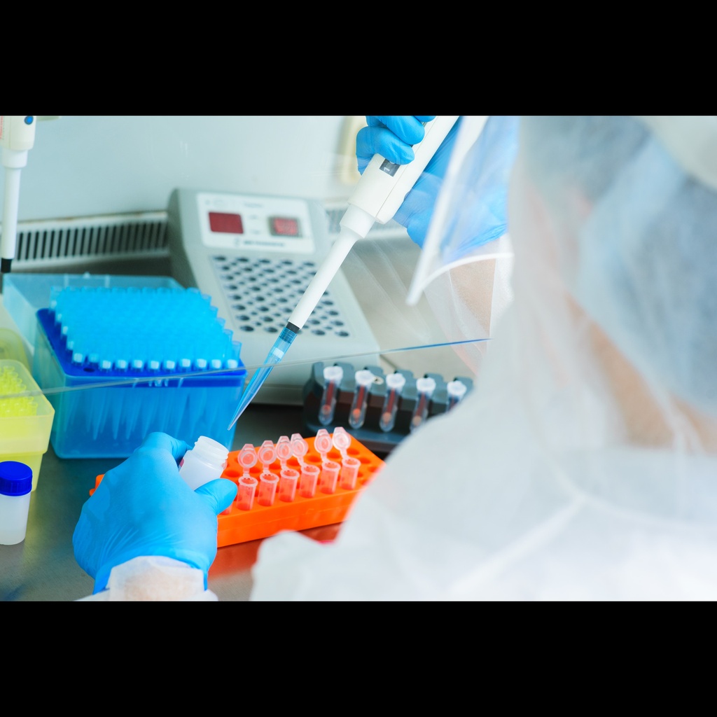 Ticksize:borne encephalitis detection kits, One Step PCR, 150 reactions