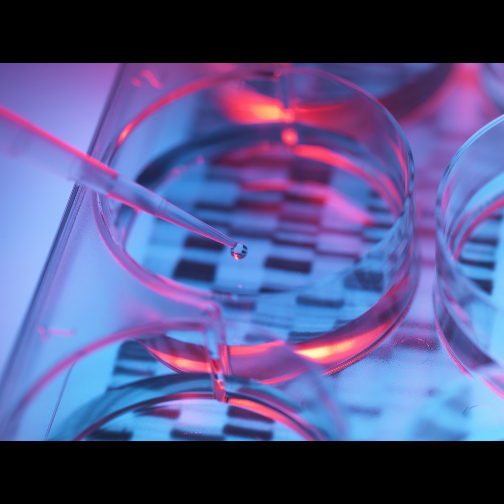 E.coli Host Cell DNA Residue Detection Kit-50 T