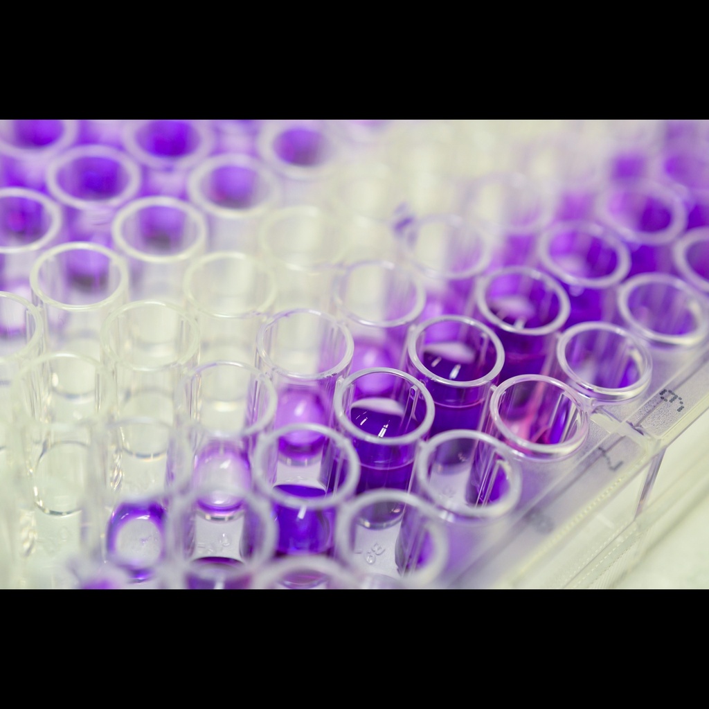 Mouse Elastase 3B  ELA3B  ELISA Kit, 96 test