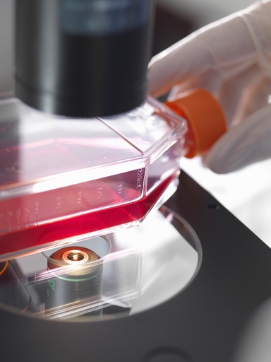 [ASTPLATE-SA2-118] Immortalized Human Aortic Endothelial Cells